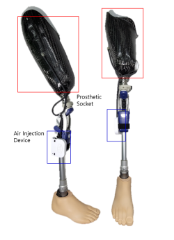[KIMM Press Release] AI-Based Prosthetic Socket Developed to Help Thigh Amputees