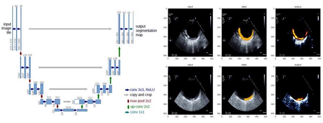 Attachment 3: Structure and Results of the U-net Model (Image)