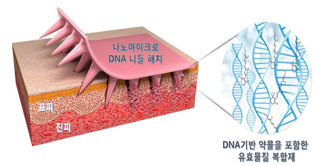 나노마이크로DNA니들패치, DNA기반 약물을 포함한 유효물질 복합재