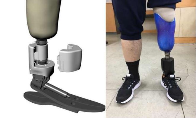 Smart Robotic Prosthesis (Photo)